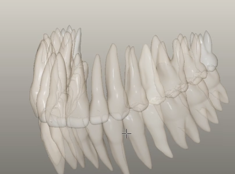 Photorealistic 3D dental rendering example