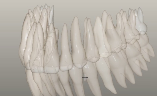 Teeth Fake Volumetric Rendering